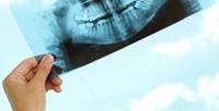 <b>Скидка до 63%.</b> Компьютерная томография зубов, челюсти и ЛОР-исследования в диагностическом центре «КТ Беляево»