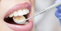 <b>Скидка до 54%.</b> Ультразвуковая чистка зубов или комплексная гигиена полости рта в стоматологической клинике «Эстетик»