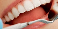 <b>Скидка до 65%.</b> Гигиена полости рта в семейной стоматологии «Нэва»