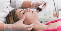 3, 5, 7 сеансов лазерно­го лечения акне на лице в салоне красоты Estettika. <b>Скидка до 73%</b>