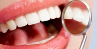 <b>Скидка до 52%.</b> Лечение кариеса с установкой пломбы в стоматологической клинике «Улыбайся»