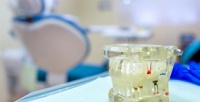 <b>Скидка 55%.</b> Эстетическая реставрация зубов в медицинском центре «Вереск»