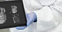 Компьютерная 3D-томография челюстно-лицевой области с консультацией терапевта, хирурга, ортопеда или ортодонта в стоматологии YesDental (1750 руб. вместо 3500 руб.)