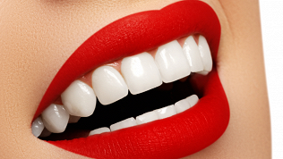 <b>Скидка до 75%.</b> Чистка зубов, лечение кариеса в стоматологической клинике «Мед-эконом»