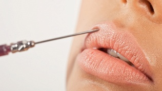 <b>Скидка до 75%.</b> Инъекции ботокса, плазмотерапия, биоревитализация, мезотерапия и процедуры для стимуляции роста волос в салоне красоты и здоровья бизнес-класса Noemi