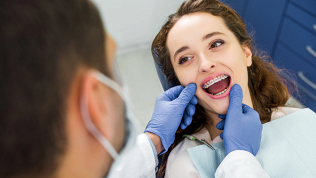 <b>Скидка до 51%.</b> Установка брекет-системы в стоматологической клинике Dental7