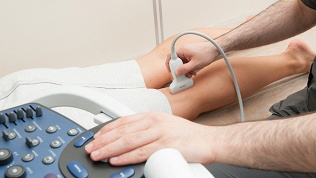 <b>Скидка до 80%.</b> Консультация хирурга-флеболога с УЗИ вен нижних конечностей, постановкой диагноза и назначением лечения, удаление сосудистых звездочек в клинике лазерной хирургии «Варикоза нет»