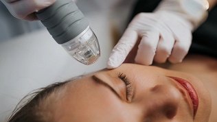 <b>Скидка до 50%.</b> Микроигольчатый RF-лифтинг в студии Hadar Clinic