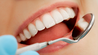 <b>Скидка до 51%.</b> Комплексная процедура ультразвуковой или комбинированной чистки зубов в стоматологии «Авторитет»