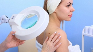 <b>Скидка до 89%.</b> Удаление новообразований в многопрофильном медицинском центре «Витбиомед+»