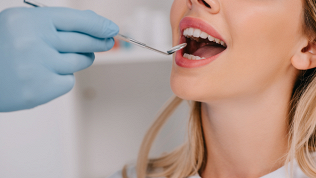 <b>Скидка до 52%.</b> Лечение кариеса, ультразвуковая чистка зубов в клинике «Ардис-Дент»