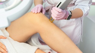<b>Скидка до 96%.</b> Абонементы на 3 или 6 месяцев лазерной эпиляции в клинике Dr. Laser
