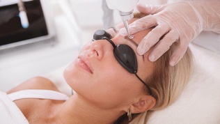 <b>Скидка до 50%.</b> Лазерное удаление тату и татуажа в клинике Beauty Vita