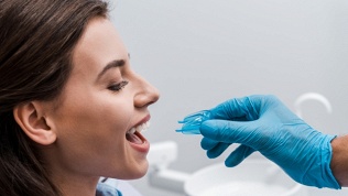 Ультразвуковая чистка зубов и по технологии AirFlow, полировка на Каширской в сети стоматологий «ЛидерСтом» (1710 руб. вместо 5700 руб.)