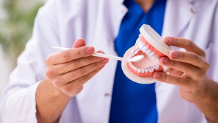 <b>Скидка до 60%.</b> Установка зубного имплантата в стоматологической клинике Smile Secret