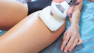 <b>Скидка до 90%.</b> Посещение сеансов вакуумно-роликового массажа от мастера Адхама