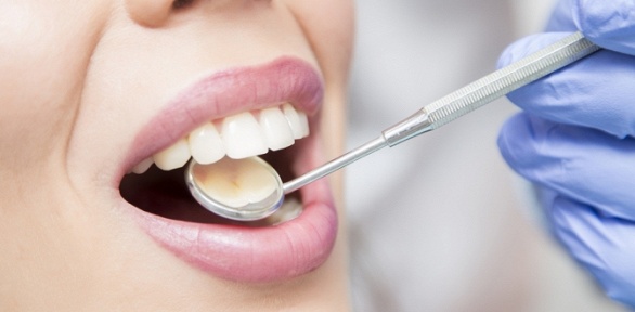 УЗ-чистка зубов, комплексная гигиена полости рта в клинике «Эстетик»