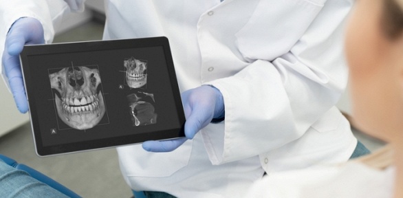 3D-томография челюстно-лицевой области в стоматологии YesDental