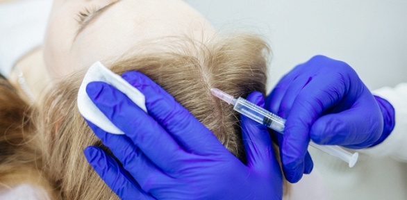 Лечение волос и кожи головы в клинике «Альянс»