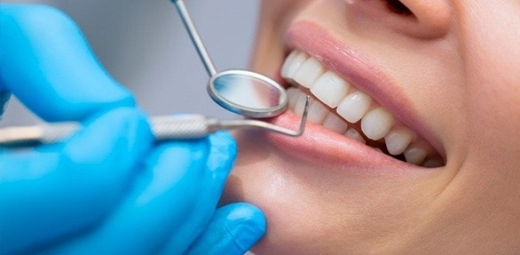Чистка зубов, гигиена полости рта в «Центре семейной стоматологии»