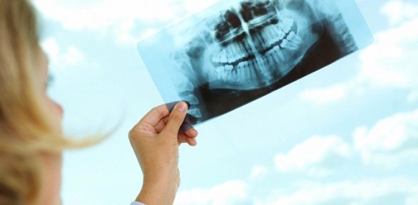 <b>Скидка до 40%.</b> Компьютерная томография зубов, челюсти и ЛОР-исследования в диагностическом центре «КТ Беляево»