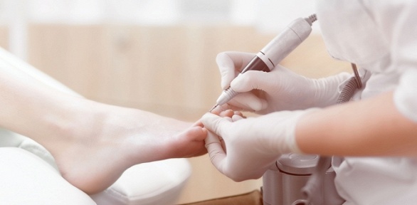 Медицинский аппаратный подологический педикюр в салоне красоты «Ноэми»