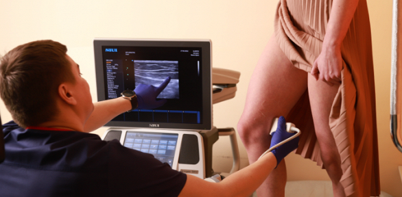 Консультация по лечению варикоза в медцентре «Олмед»