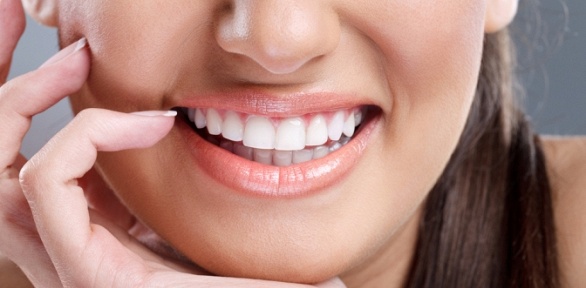 Косметическое отбеливание зубов в студии Beauty Smile