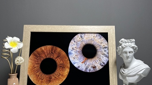 Фотография радужки глаз