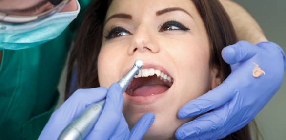 Ультразвуковая чистка зубов по системе AirFlow в стоматологии «Селена-Дент»