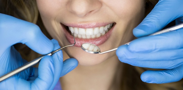 Чистка, лечение кариеса или удаление зуба в клинике Smile Secret