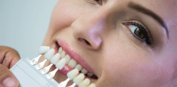 Чистка зубов, диагностика, лечение кариеса в стоматологии «МДХ-Сервис»