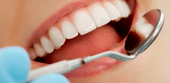 Гигиена полости рта в семейной стоматологии «Нэва»
