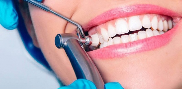 Гигиена полости рта, лечение кариеса или удаление зуба в клинике «ДентАмир»