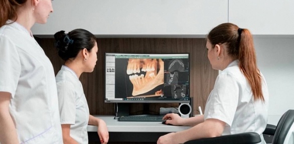 3D-томография челюстно-лицевой области в клинике «О`дент»
