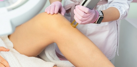 Эпиляция александритовым лазером в клинике эстетической косметологии Ingart