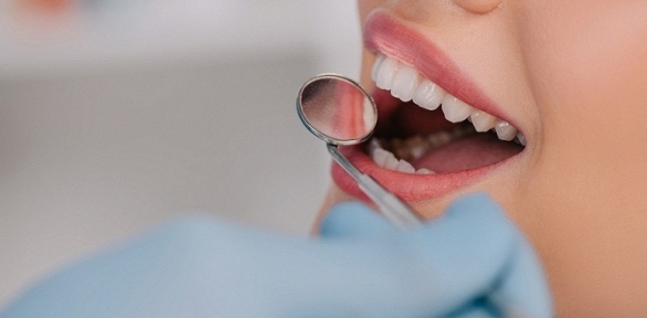 Ультразвуковая, комплексная чистка зубов в стоматологии «А-дент»