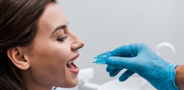 Чистка зубов на Каширской в сети стоматологий «ЛидерСтом»