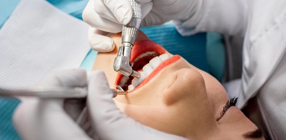 Ультразвуковая чистка зубов в стоматологическом кабинете «Арт-стом»