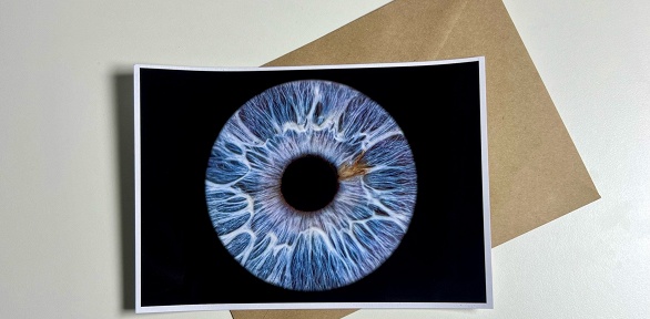 Фото радужки глаз