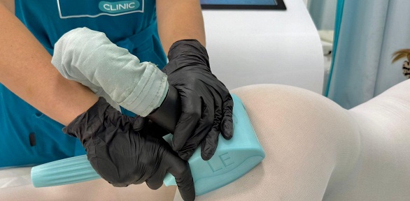 Сеансы LPG-массажа всего тела в центре «Арт Лайф Slim & Sport»